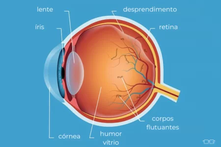 estrutura do olho e moscas flutuantes